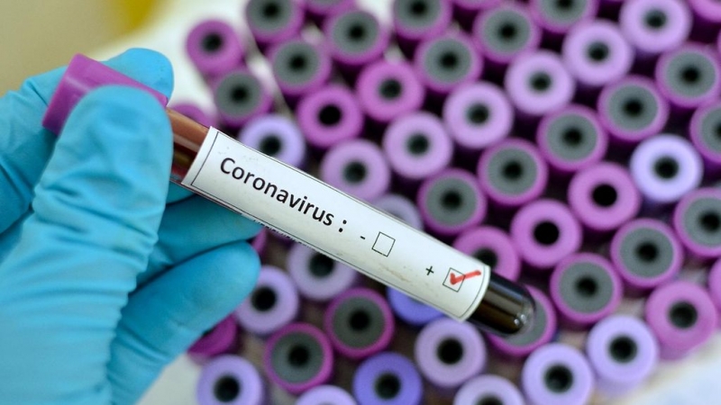 Koronavirüsle ilgili antikor iddiası: Yüzde yüz engelliyor! 4 gün içinde vücuttan atıyor
