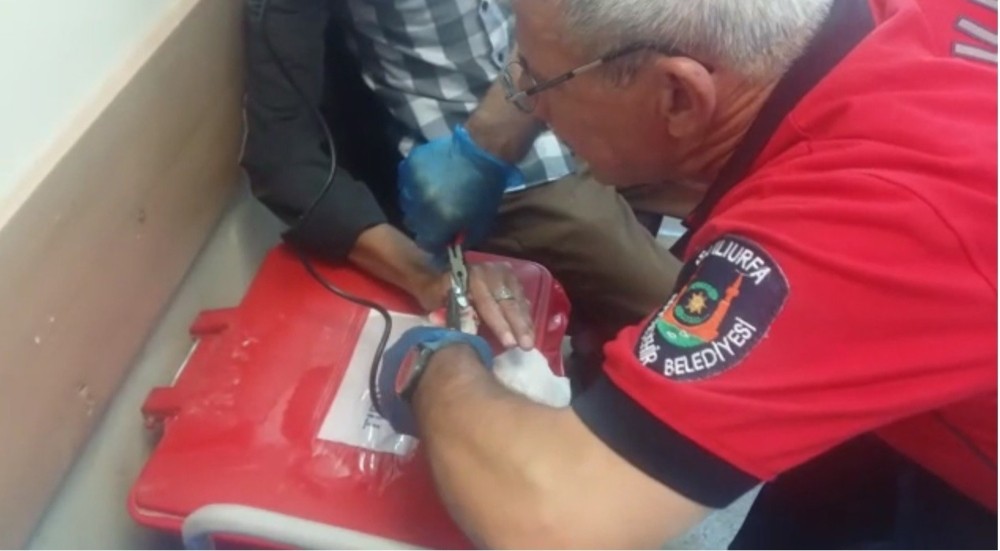 İtfaiyeden yüzük operasyonu