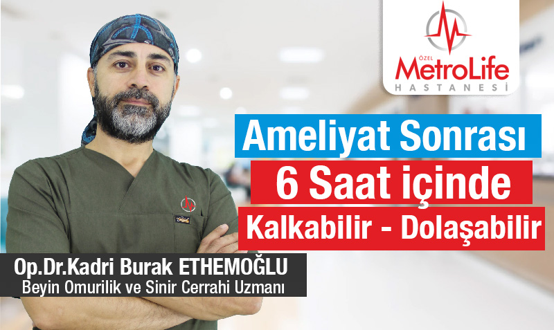Bel Fıtığıyla Başa Çıkmanın Güvenli Yolu: Özel Metrolife!"