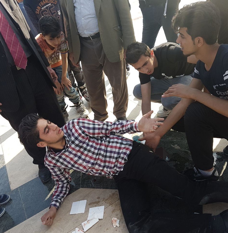 Şanlıurfa’da bıçaklı kavga: 1 yaralı