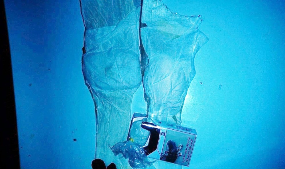 Uyuşturucuyu sargı bezleriyle bacaklarına saran şahıs yakalandı