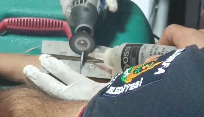 Çocuğun parmağına sıkıştırdığı cıvata pulu kesilerek çıkartıldı