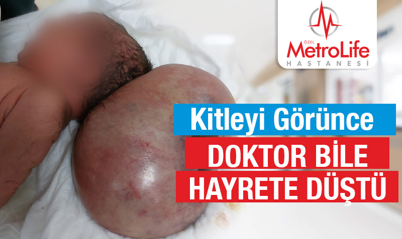 Doktorları bile hayrete düşüren olay!