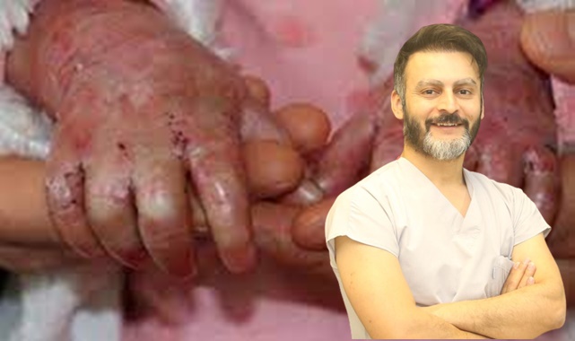 Dünyada sayılı doktorun yaptığı operasyon, artık Metrolife’de yapılıyor