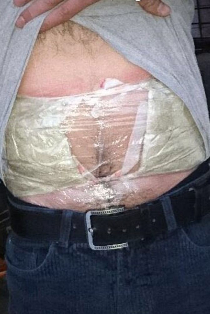 Yolcunun karnına sarılı uyuşturucuyu polis buldu