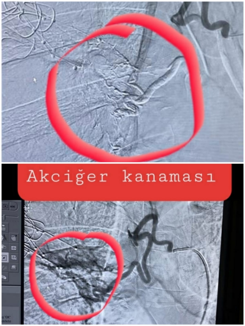 Harran Üniversitesi Hastanesi Bölgede söz sahibi olmaya devam ediyor.