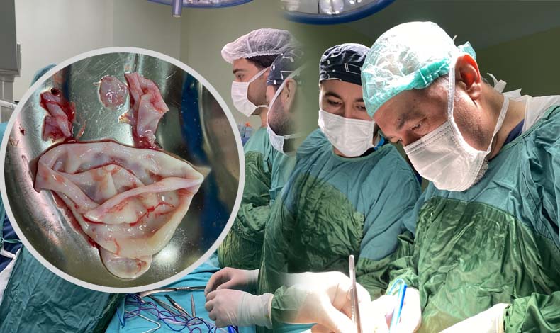 Karaciğerinde kist bulunan hasta, 2 saatlik operasyon sonrası sağlığına kavuştu.