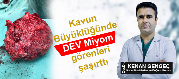 Kavun büyüklüğünde Miyom Görenleri şaşırttı