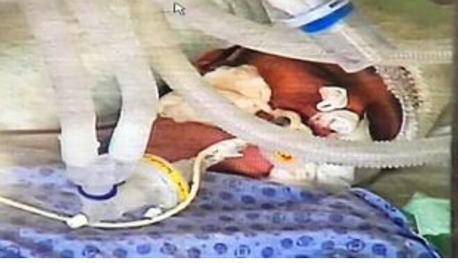 Kocası tarafından satırla başından yaralanan kadın öldü