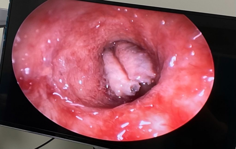 Kulaktan çıkana inanamayacaksınız !