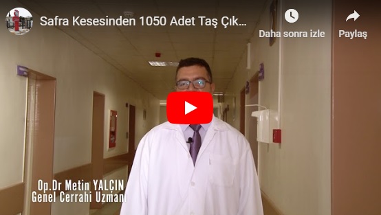 Safra Kesesinden 1050 Adet Taş Çıkarıldı.