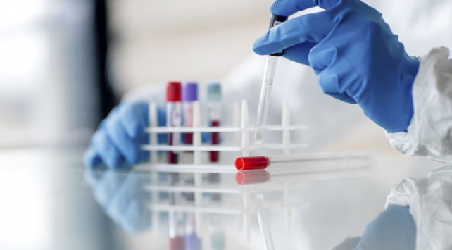 Türkiye'de can kaybı 30'a yükseldi