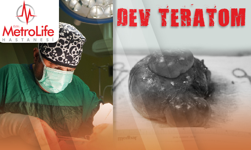 Urfa’da doğan bebek kendi ağırlığın 3 katı büyüklüğünde kitle ile dünyaya geldi